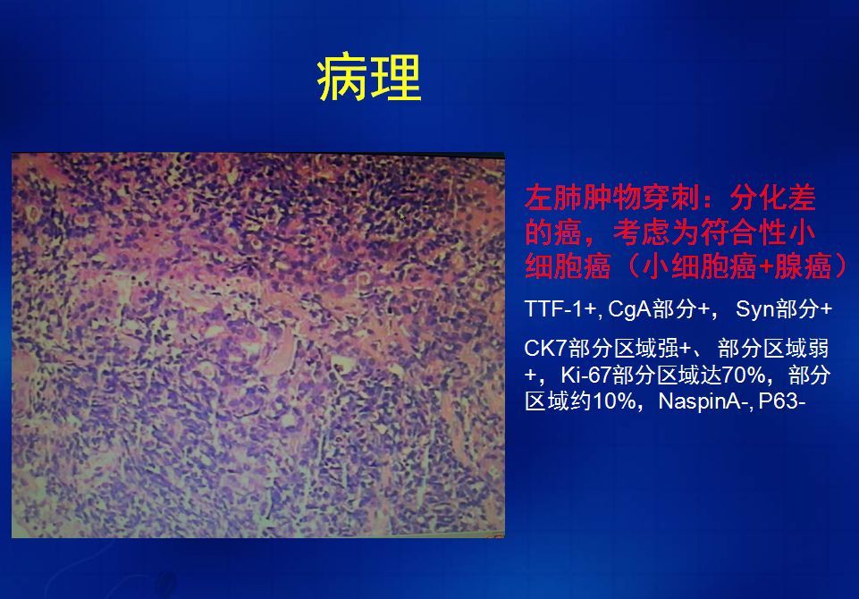 細胞膜抗原功能_細胞膜抗原_膜抗原是什么