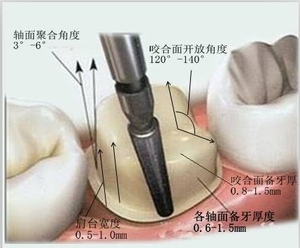 斜面與哪些因素有關(guān)