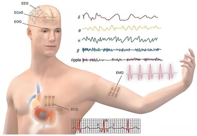 馬斯克腦機實驗引發思考：人類大腦或被超級系統連接，世界是虛擬的？